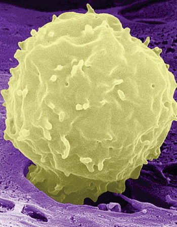 Image: False-color scanning electron micrograph (SEM) of a neutrophil (Photo courtesy of UC San Diego School of Medicine).